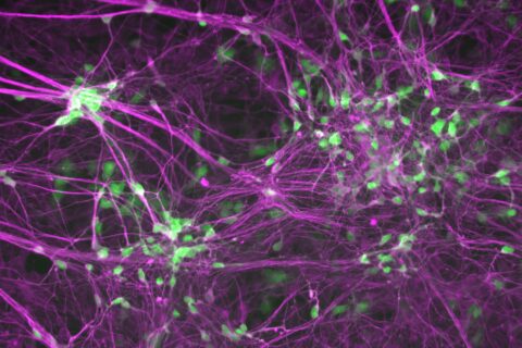 Motor neurons