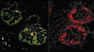 Study maps how genes instruct kidneys to develop differently in mice and humans