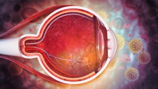 $6 million grant advances potential treatment for common cause of vision loss