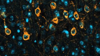 How to clear a toxic protein that can lead to Alzheimer’s and related diseases