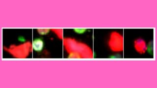 Cancer-associated cells